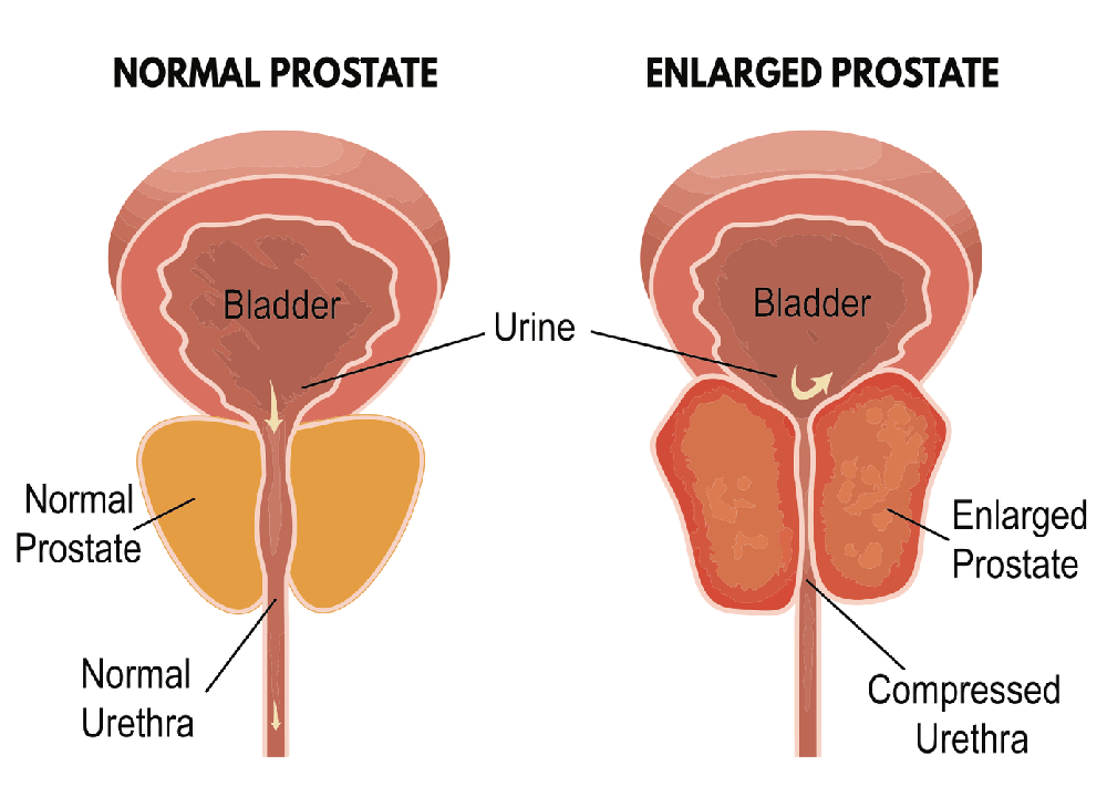 P-Spot Massage